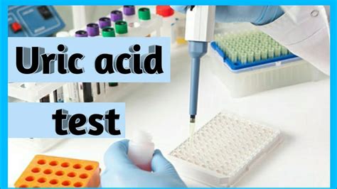 Uric Acid Test In Hindi Uric Acid Test Kaise Hota H Uric Acid Test यूरिक एसिड टेस्ट