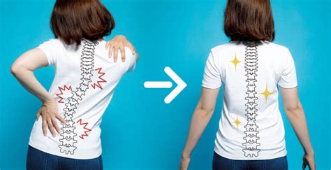 Posture for Neck Pain: Exercises To Improve Your Posture