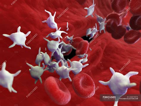 Illustration Of Platelets Fixing Wound With Erythrocytes Blood Flow