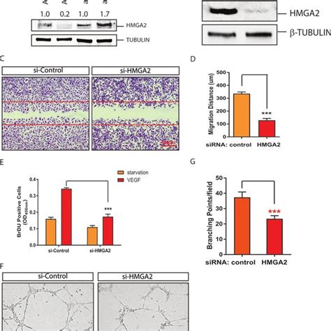 Regulation Of EC Angiogenic Activities By Let 7 Target HMGA2 Gene A