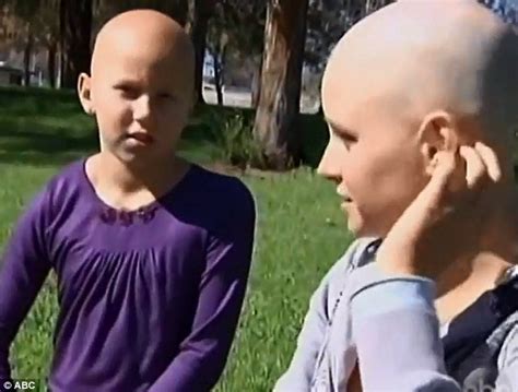 Being Bald In Hollywood Model And Actress Struck By Alopecia Reveals