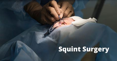 Squint Surgery Cost In Delhi- EyeMantra