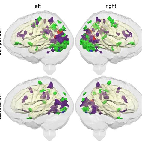 Significant Differences In Brain Activation Pattern For Individual