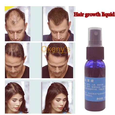 Hair Loss Cure For Women Fashionnfreak