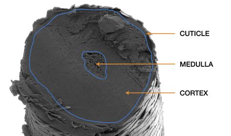 Human Hair Under Electron Microscope