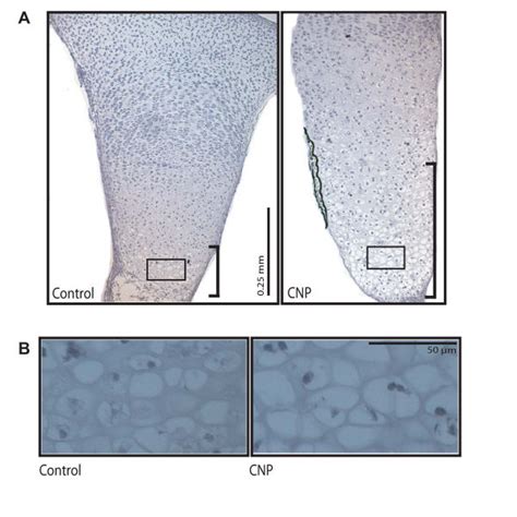 Cnp Induces Expansion Of The Hypertrophic Zone Hematoxylin And Eosin