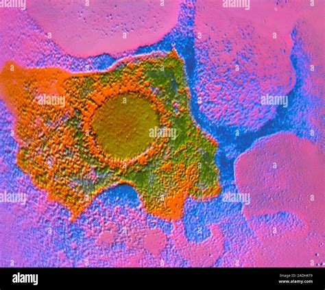 False Colour Transmission Electron Micrograph TEM Of A Single Virion