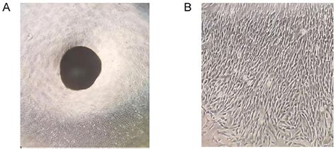 Human Umbilical Cord Mesenchymal Stem Cells A Huc Mscs Growth From