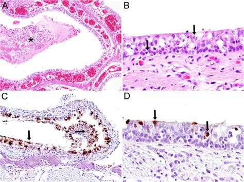 Histopathology And Immunohistochemistry Of Nasal Respiratory Mucosa And Download Scientific