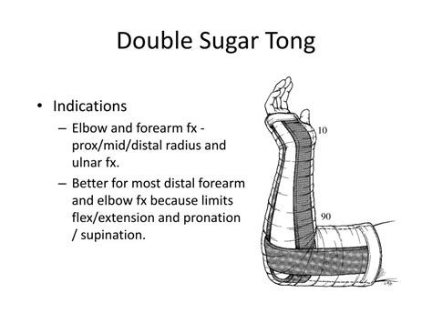 Ppt Splinting Workshop Broward General Medical Center Powerpoint Presentation Id 3019033