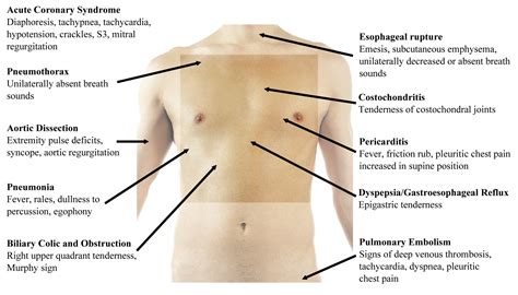 Chest Pain Physician Assistant Clinics