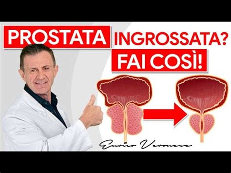 Riduci La Prostata Ingrossata Con L Alimentazione Youtube