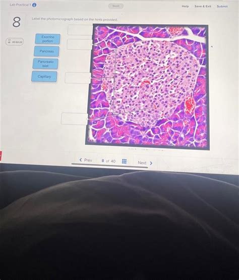 Solved Lab Practical Label The Photomicrograph Chegg