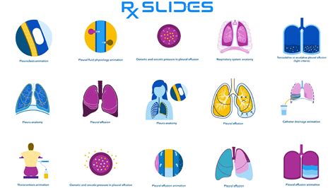 Download Pleural Effusion Powerpoint Template Rxslides