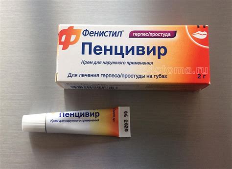 Герпес на губах – лечение, фото, мазь от герпеса, как вылечить быстро