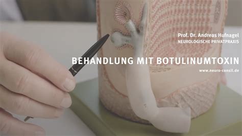 Behandlung Mit Botulinumtoxin Youtube