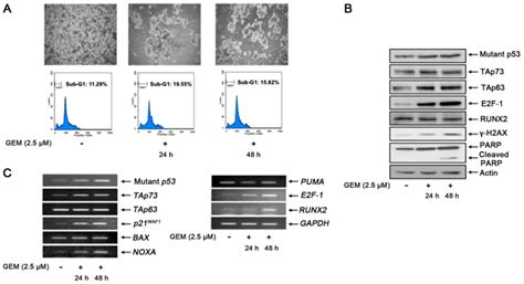 Impact Of Runx2 Gene Silencing On The Gemcitabine Sensitivity Of P53