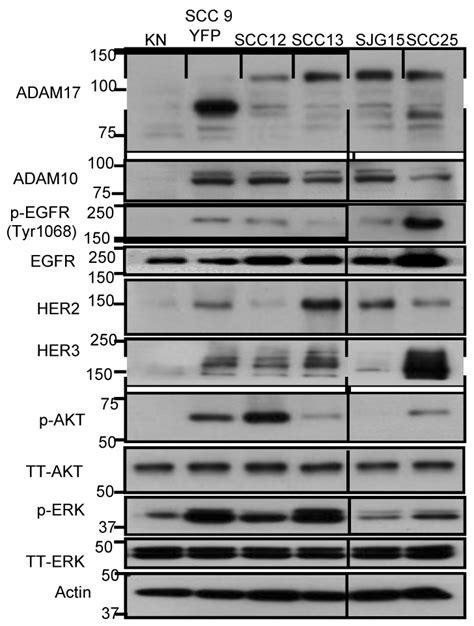 Characterization Of P Egfr Her2 Her3 P Akt P Erk12 And