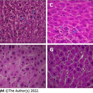 Histological Sections Of Rat Liver A Normal Control The Black Arrow