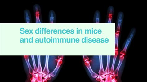 Sex Differences And Autoimmune Disease