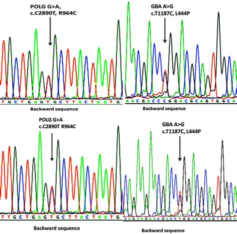 Sequence chromatograms showing the single nucleotide change in GBA and ... 