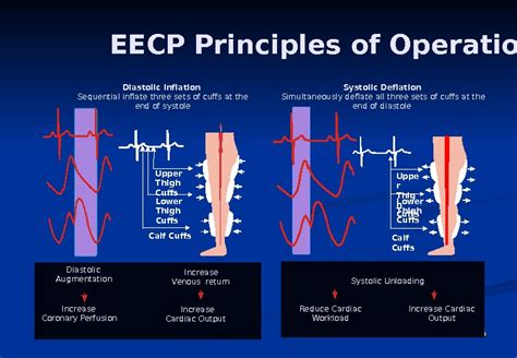 Enhanced External Counterpulsation