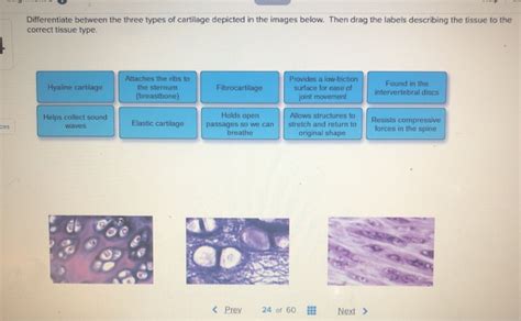 Types Of Cartilage Tissue