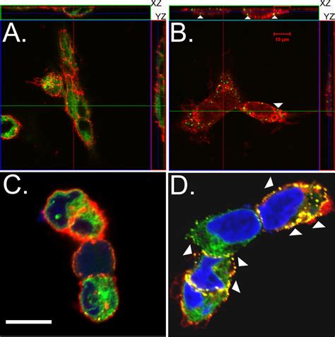 Thapsigargin Induces YFP STIM1 Puncta Translocation To The Plasma