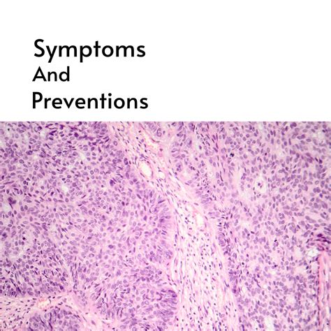 Basal Cell Carcinoma — Symptoms and Preventions | by Spirals Health ...