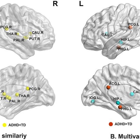 Regions Of Significant Differences In Nodal Profiles Of Brain Gray