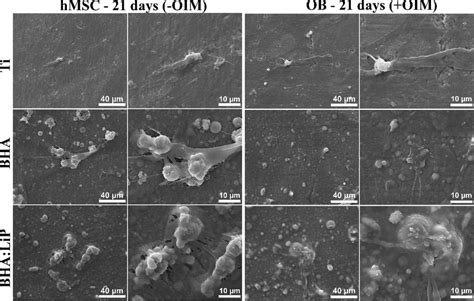 Sem Micrographs Of Human Mesenchymal Stem Cells Differentiated To Download Scientific Diagram