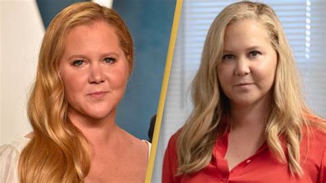 Amy Schumer Reveals She Has Compulsive Hair Pulling Disorder