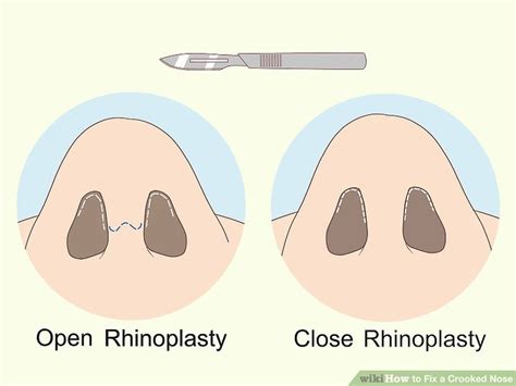 7 Ways To Fix A Crooked Nose Wikihow