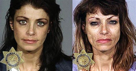 Before And After Drug Use Photos