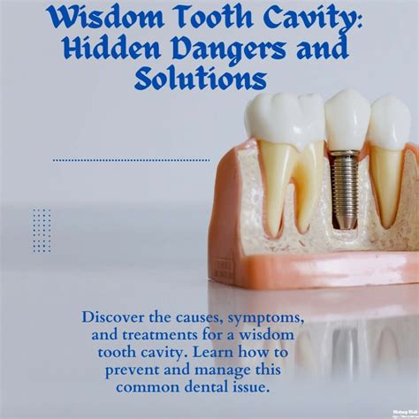 Wisdom Tooth Cavity Hidden Dangers And Solutions History Visit