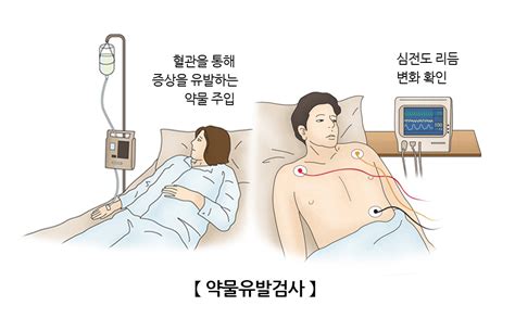 약물유발검사 검사시술수술정보 의료정보 건강정보 서울아산병원