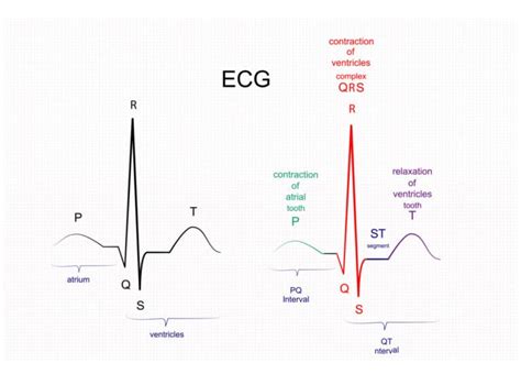 Are Ectopic Beats Dangerous? | Stop SVT