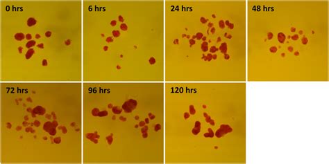 Dithizone Staining Of Islets Cultivated For Different Time