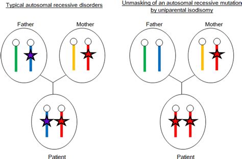 Figure From Uniparental Disomy As A Cause Of Pediatric Endocrine