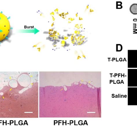 Fibrin Targeting Low Intensity Focused Ultrasound Lifu Responsive