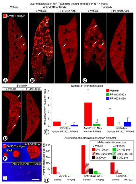 Inhibition Of Vegf And Or C Met Effect On Number And Size Of Liver