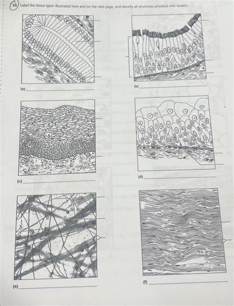 Solved Label The Tissue Types Illustrated Here And On Chegg