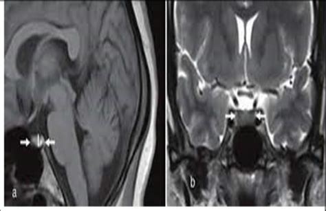 Pituitary MRI-normal study. | Download Scientific Diagram