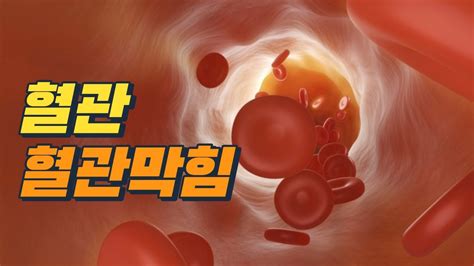 막힌 혈관을 뻥 뚫어주는 음식들오늘은 탁해진 혈액을 맑게 해주며 이것을 매일 먹으면 막힌 혈액순환 뻥 뚫려요 Youtube