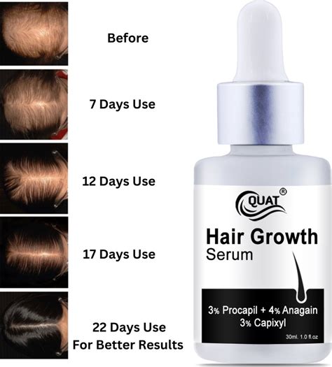 Top More Than 165 Folirich Hair Growth Serum Best Camera Edu Vn