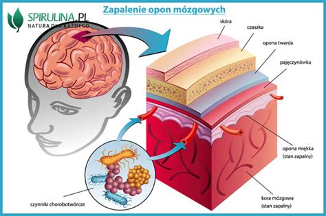 Zapalenie Opon M Zgowych Algi Spirulina I Chlorella