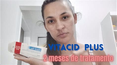 Tratamento Para Clareamento De Manchas No Rosto Vitacid Plus Youtube