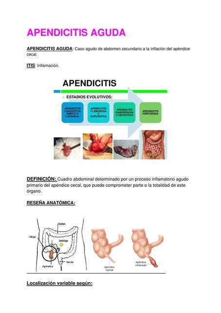 Apendicitis Aguda Y Colopatia Diverticular UDocz 7488 The Best Porn