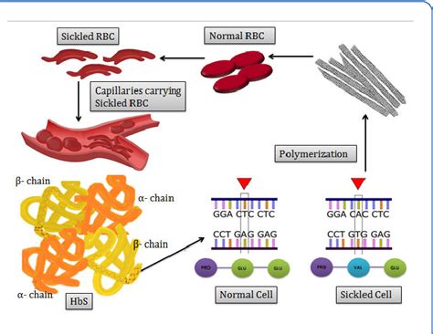 Figure 3 From Sickle Cell Anaemia A Synopsis Of The Inherited Ailment