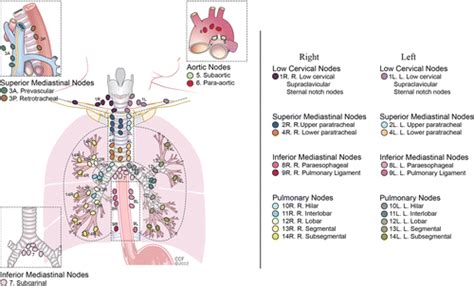 International Association For The Study Of Lung Cancer Iaslc Lymph